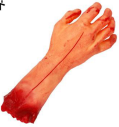 SEVERED WRIST