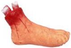 SEVERED RIGHT ANKLE