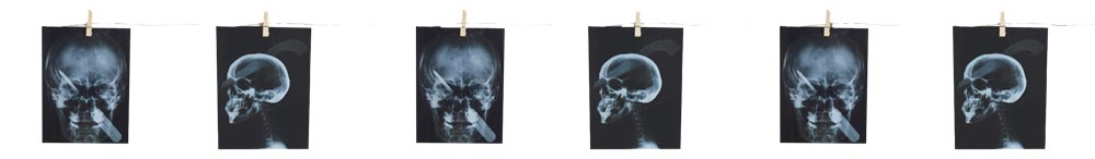 Torture X-Ray